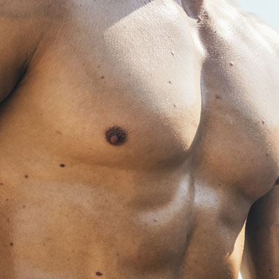 Top Surgery<br>Trans Man | Ocean Clinic Marbella